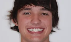 Thumbnail control image for Close-up of a young man with dark hair smiling with visible white teeth against a plain background.