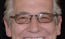 Thumbnail control image for Smiling middle-aged man wearing glasses with short salt-and-pepper hair and missing front tooth on black background