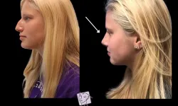 Thumbnail control image for a woman with blonde hair