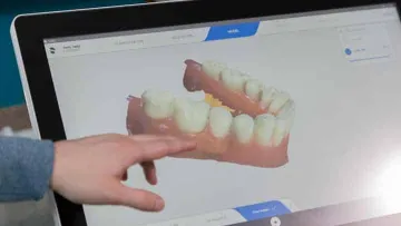 Hand pointing at 3D digital dental model displayed on touchscreen monitor for dental analysis.