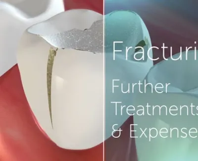 Dental Crowns