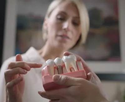 Dental Implants