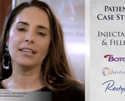 Botox Case Study