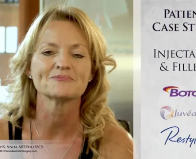 Botox Case Study