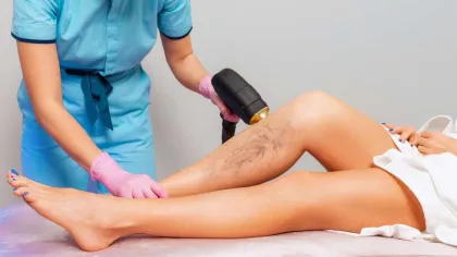 Professional laser hair removal treatment on a woman's legs showing before and after results.
