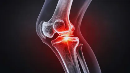 X-ray image of a human knee joint highlighting inflammation and pain with a red glowing area
