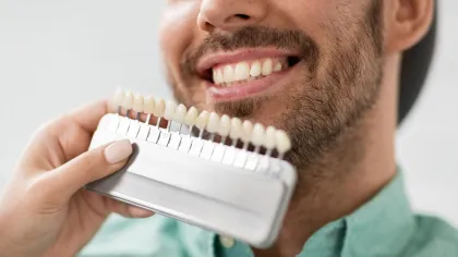 a man holding a set of sample tooth veneers