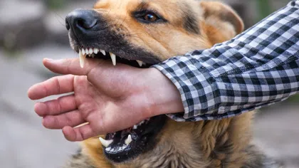 German shepherd dog biting a person's arm wearing a checkered shirt outdoors.