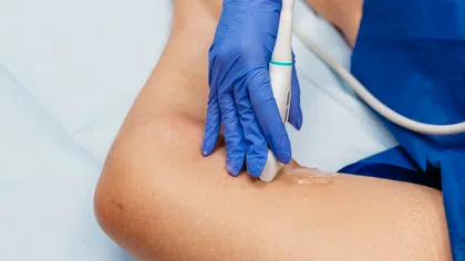 Medical professional in blue gloves performing ultrasound on patient's leg with gel in clinical setting.