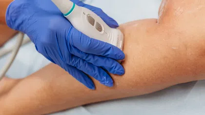 Medical professional performing ultrasound scan on a patient's leg with gloves and ultrasound device.