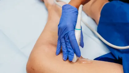 Close-up of medical professional performing ultrasound on patient's leg with gel and transducer.