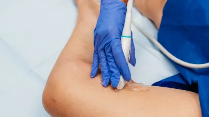 Medical professional in blue gloves performing ultrasound on patient's leg with gel in clinical setting.