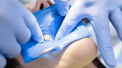 Dentist wearing blue gloves places dental dam around patient's tooth during procedure