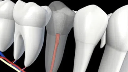 3D illustration of human teeth showing internal nerve and blood vessels against a black background
