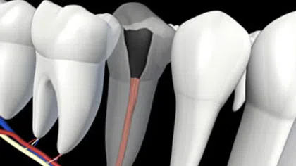 Cross-section of human teeth showing internal root canal anatomy and surrounding nerves and vessels.