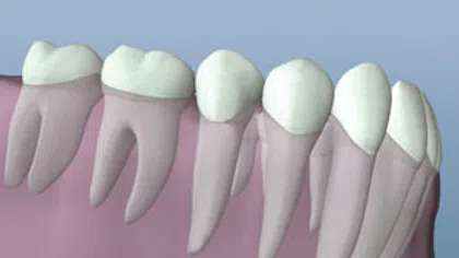 3D illustration of human teeth and gums showing molars, premolars, and canines in a dental model.