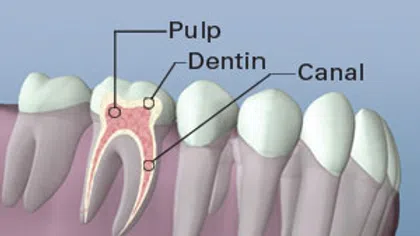 Cross-section of a molar tooth showing pulp, dentin, and canal structures inside the gum.
