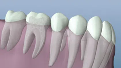3D illustration of human molars and premolars showing tooth roots and gum structure with dental crown surfaces.