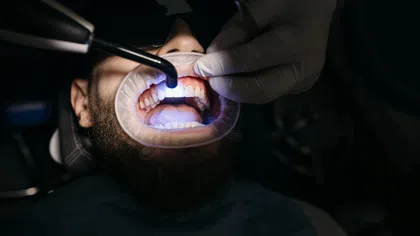Dentist performing teeth whitening or dental curing light treatment on patient in dental clinic.