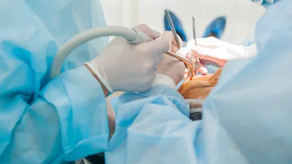 Dentists wearing blue surgical gowns performing dental surgery on a patient under bright light.