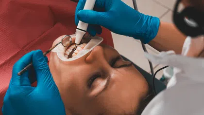 Dentist wearing blue gloves performing dental cleaning on patient's teeth with dental tools in clinic.