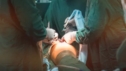 a group of people performing surgery