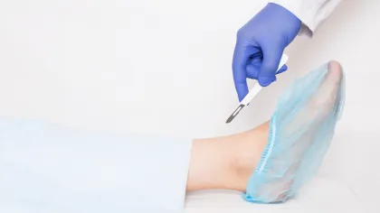 a person wearing gloves and a scalpel