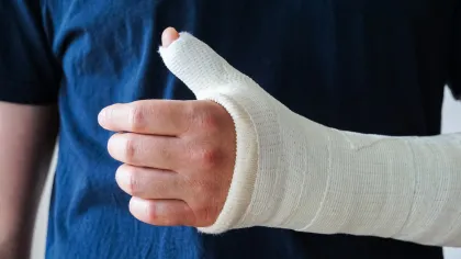 a person wearing a cast