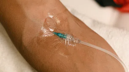 Close-up of an intravenous IV catheter inserted in a patient's arm secured with transparent medical tape.