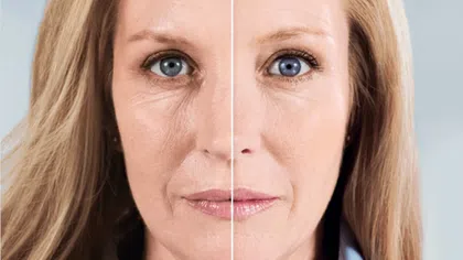Close-up split image showing before and after effects of anti-aging treatment on a woman's face.