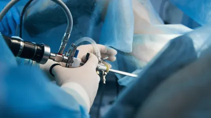 Surgeon using laparoscope for minimally invasive surgery in a sterile operating room environment.