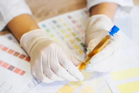 What Is a Healthy Urine Color, and What Is Not? 