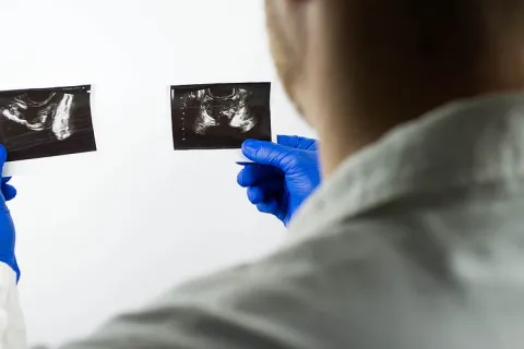 Different Symptoms of BPH vs. Prostate Cancer 