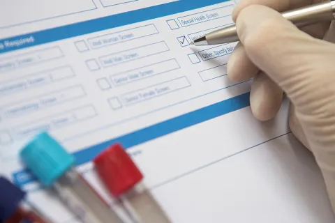 What is a PSA Test? How to Understand Your Levels