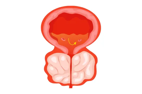 Illustration of a human prostate gland highlighting internal anatomy in red and pink shades on a white background.