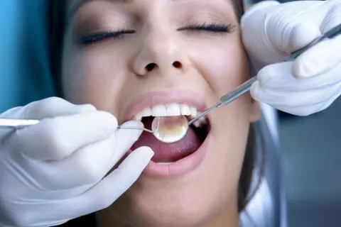 Get a Spring Cleaning for Your Teeth