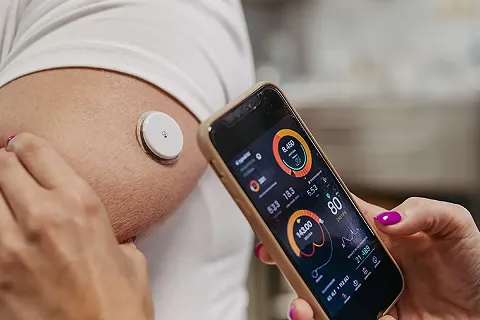 Person with glucose monitoring sensor on arm checks blood sugar levels on smartphone app.