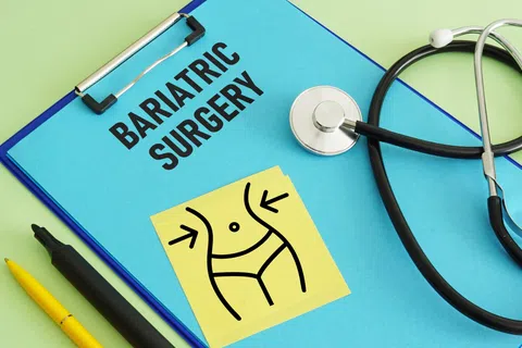 The Future of Bariatric Aftercare: Health Beyond Surgery