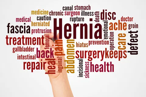 Hernia Repair Surgery in Atlanta: Your Health in Skilled Hands