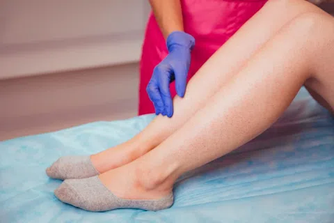 Does Vein Treatment Hurt? A Candid Breakdown of What to Expect