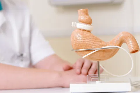 The Bariatric Surgery Process Explained