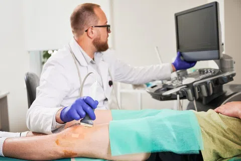 What to Expect During and After Vein Treatment
