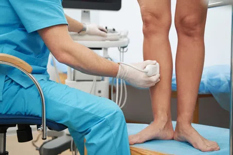 What Really Causes Spider Veins? The Truth About Those Pesky Leg Lines