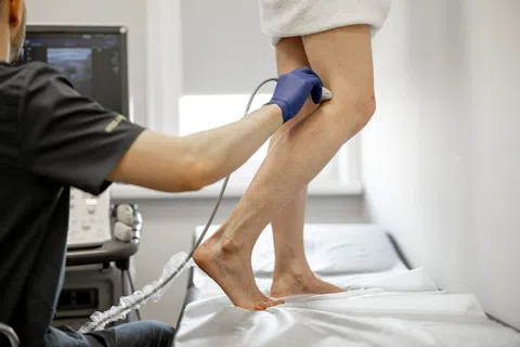 Is Vein Ablation Painful? Real Talk from Patients Who’ve Been There