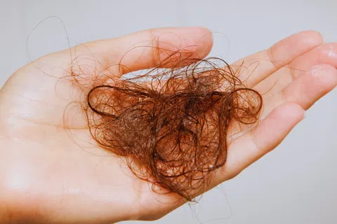 Hand holding a clump of brown hair strands, illustrating hair loss or shedding issues.