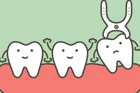 What to Expect With a Tooth Extraction