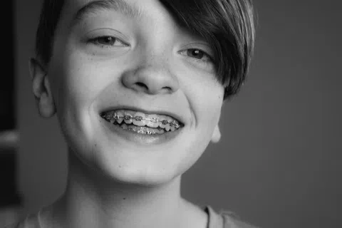Black and white close-up of a smiling teenager with braces and side-swept hair
