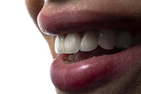 Close-up of a smiling mouth showing white teeth and natural lips against a white background