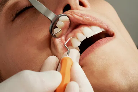 Close-up of dental examination showing a endodontist using tools to inspect a patient's teeth and gums