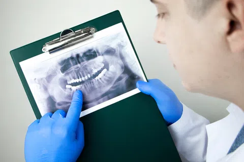 Dentist wearing blue gloves pointing at a dental X-ray on a clipboard during examination.